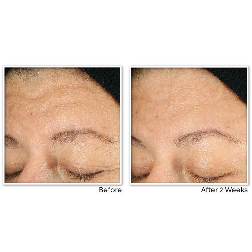 MULTI CORREXION® Revive   Glow Gel Cleanser