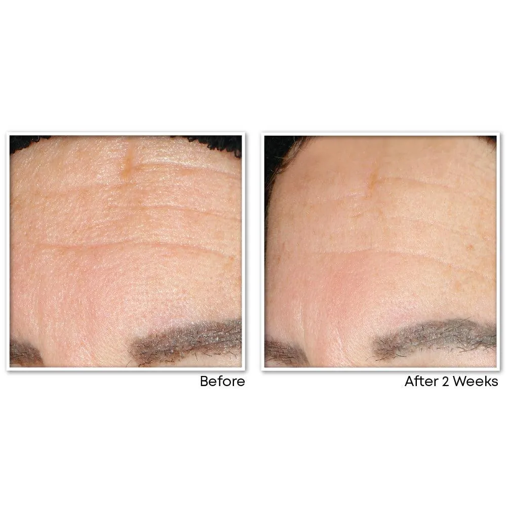 MULTI CORREXION® Revive   Glow Gel Cleanser